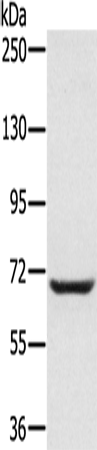 Rabbit Polyclonal Antibody to PLS3