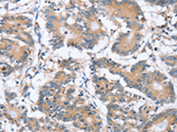 Rabbit Polyclonal Antibody to PLCZ1