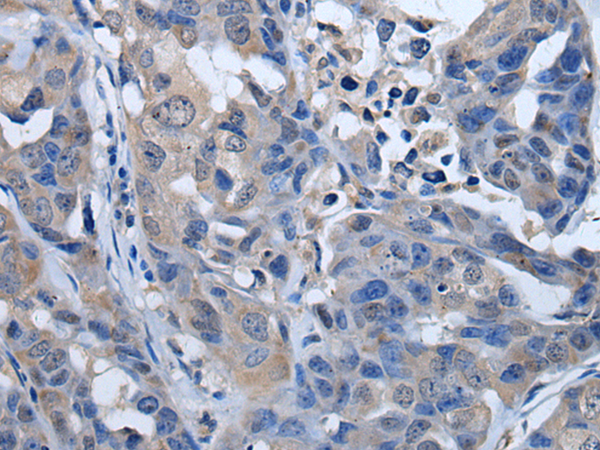 Rabbit Polyclonal Antibody to PLK4