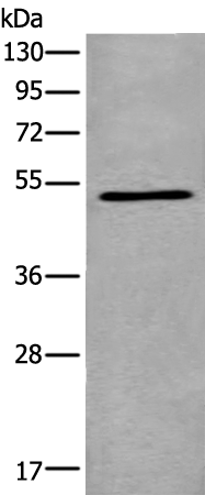 Rabbit Polyclonal Antibody to PNLIPRP1
