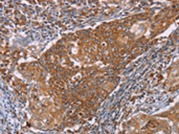Rabbit Polyclonal Antibody to PMPCB