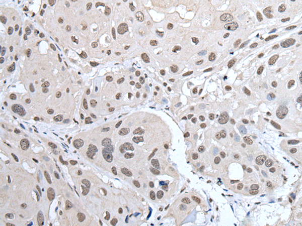 Rabbit Polyclonal Antibody to POT1