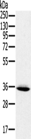 Rabbit Polyclonal Antibody to PPP2CA