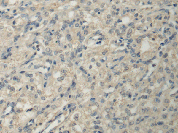 Rabbit Polyclonal Antibody to PPM1A