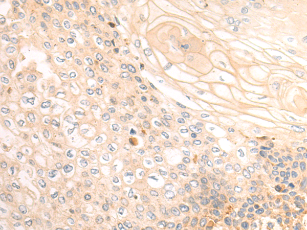 Rabbit Polyclonal Antibody to PRAME