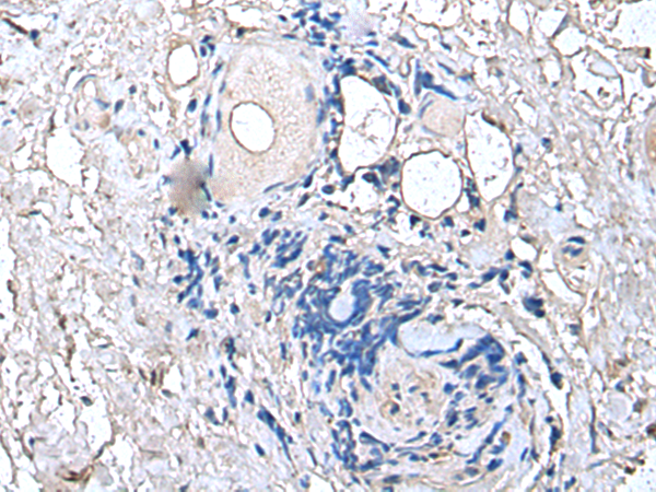 Rabbit Polyclonal Antibody to PTP4A1