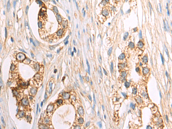 Rabbit Polyclonal Antibody to PRM1