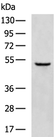 Rabbit Polyclonal Antibody to TMPRSS2