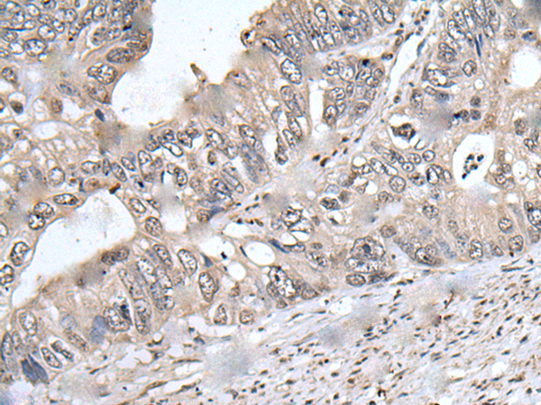 Rabbit Polyclonal Antibody to PRUNE1