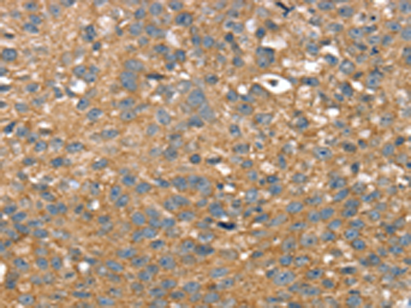 Rabbit Polyclonal Antibody to TWF1