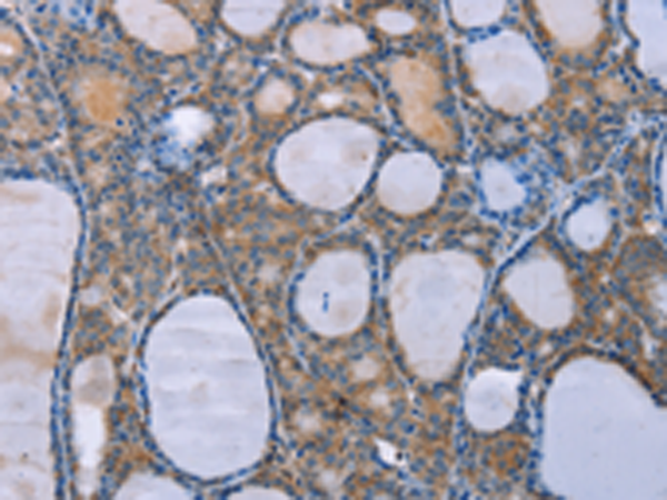 Rabbit Polyclonal Antibody to OPTN