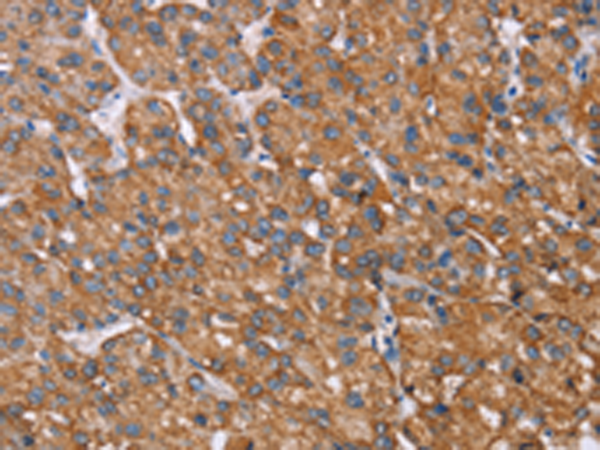 Rabbit Polyclonal Antibody to RMDN3