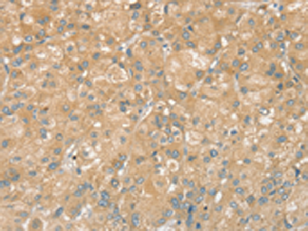 Rabbit Polyclonal Antibody to PTPN7