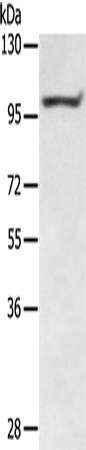 Rabbit Polyclonal Antibody to PTPN22
