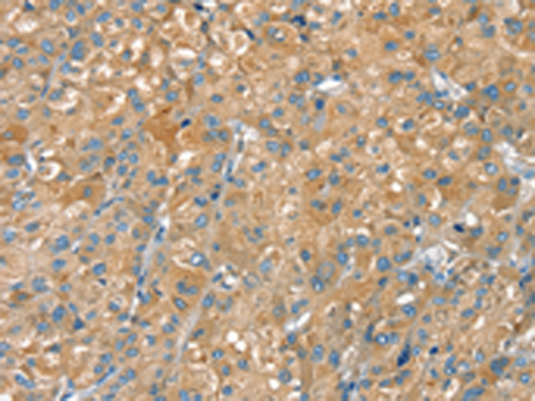 Rabbit Polyclonal Antibody to PTPRN