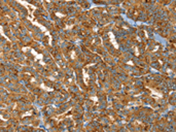 Rabbit Polyclonal Antibody to PTPN3