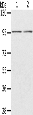 Rabbit Polyclonal Antibody to PYGL