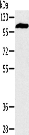 Rabbit Polyclonal Antibody to PYGM
