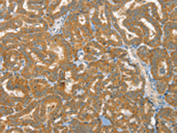 Rabbit Polyclonal Antibody to RAB25