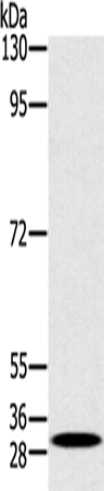 Rabbit Polyclonal Antibody to RAB27A