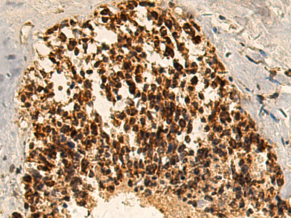 Rabbit Polyclonal Antibody to RAE1