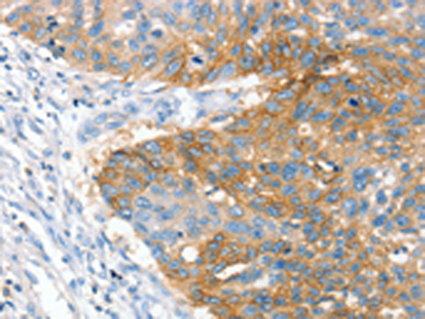 Rabbit Polyclonal Antibody to CRADD