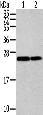 Rabbit Polyclonal Antibody to RAN