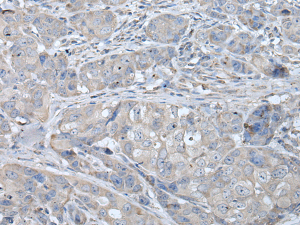 Rabbit Polyclonal Antibody to RASA1