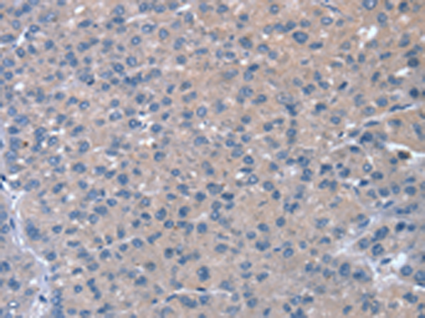 Rabbit Polyclonal Antibody to RASA4