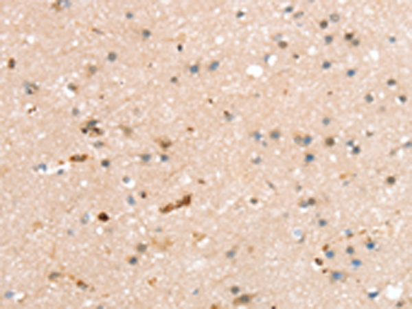 Rabbit Polyclonal Antibody to RASGEF1A