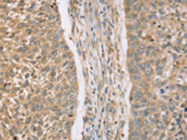 Rabbit Polyclonal Antibody to RASSF4