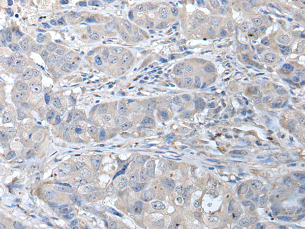 Rabbit Polyclonal Antibody to RASSF8