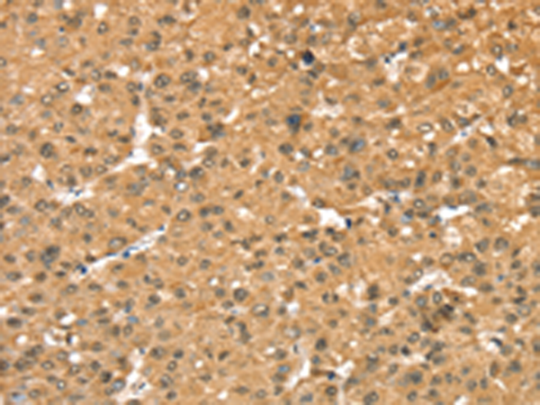 Rabbit Polyclonal Antibody to RASSF9