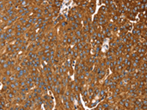 Rabbit Polyclonal Antibody to RASSF3