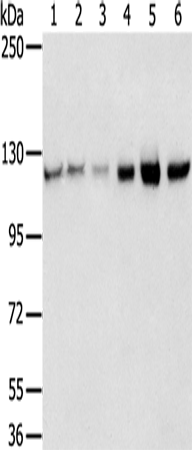 Rabbit Polyclonal Antibody to RBM5