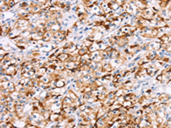Rabbit Polyclonal Antibody to RDH11
