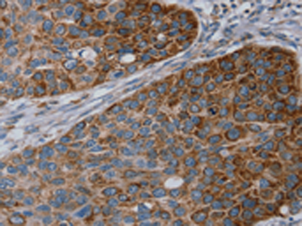 Rabbit Polyclonal Antibody to REG4