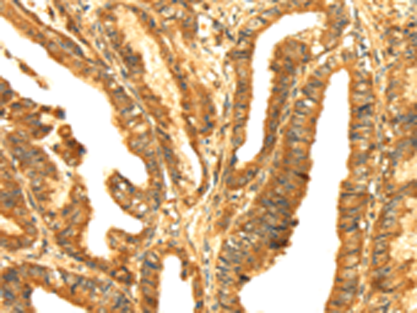 Rabbit Polyclonal Antibody to RLN1