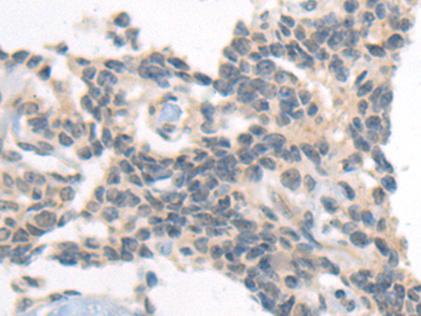 Rabbit Polyclonal Antibody to SEMA4D