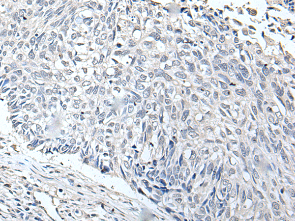 Rabbit Polyclonal Antibody to RERG
