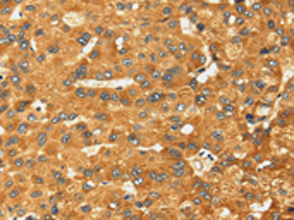 Rabbit Polyclonal Antibody to RFFL