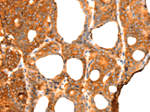 Rabbit Polyclonal Antibody to RGS5