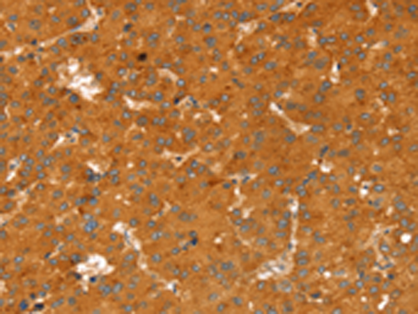 Rabbit Polyclonal Antibody to RGS4