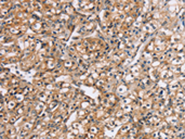 Rabbit Polyclonal Antibody to RGS1