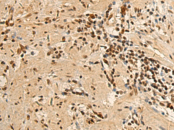 Rabbit Polyclonal Antibody to RGS6
