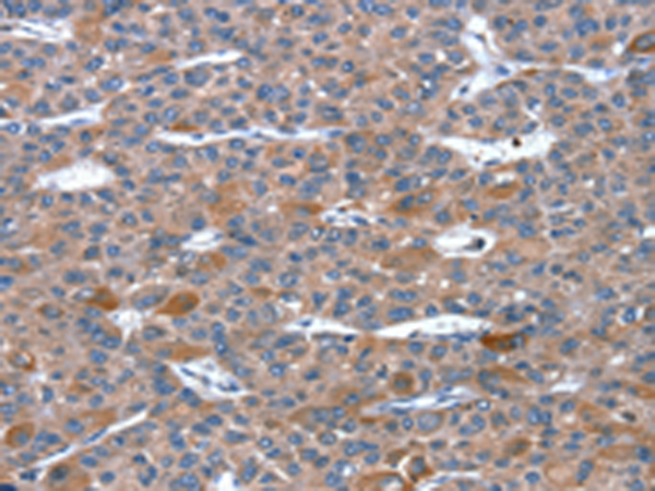 Rabbit Polyclonal Antibody to RGS11