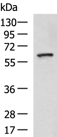 Rabbit Polyclonal Antibody to RGS14