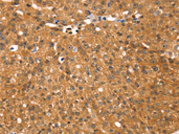 Rabbit Polyclonal Antibody to RGS22