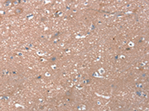 Rabbit Polyclonal Antibody to RHEB
