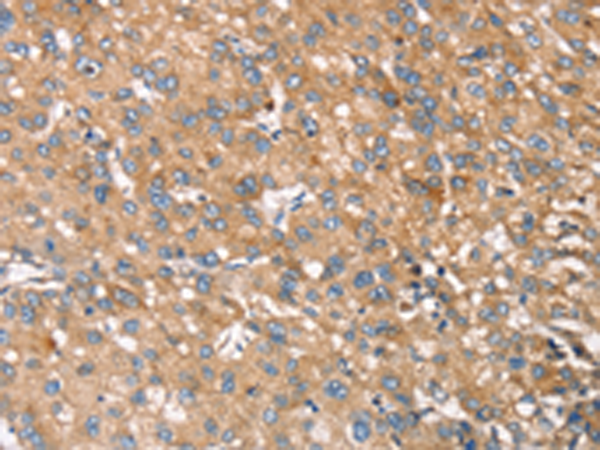 Rabbit Polyclonal Antibody to RNASET2